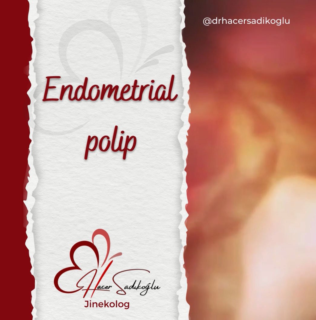 Endometrial polip